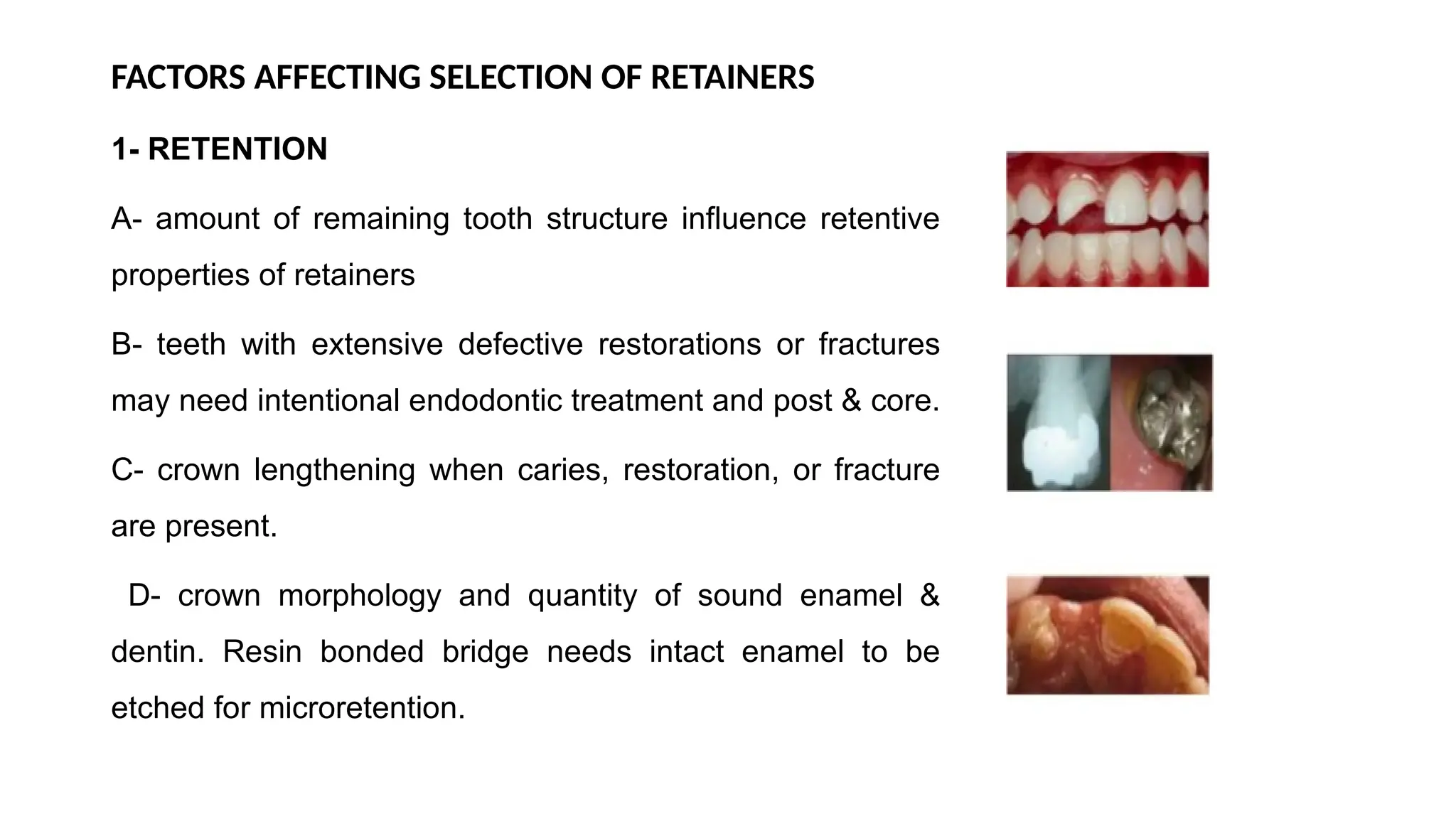 FACTORS AFFECTING SELECTION OF RETAINERS
1- RETENTION
A- amount of remaining tooth structure influence retentive
properties of retainers
B- teeth with extensive defective restorations or fractures
may need intentional endodontic treatment and post & core.
C- crown lengthening when caries, restoration, or fracture
are present.
D- crown morphology and quantity of sound enamel &
dentin. Resin bonded bridge needs intact enamel to be
etched for microretention.
 