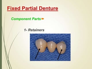Fixed Partial Denture

Component Parts
1- Retainers
 