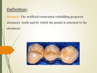 Definition:
Retainer: The artificial restoration rebuilding prepared
abutment tooth and by which the pontic is attached to the
abutment.
 