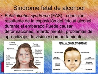 Síndrome fetal de alcohool
• Fetal alcohol syndrome (FAS) - condición
resultante de la exposición del feto al alcohol
durante el embarazo Puede causar
deformaciones, retardo mental, problemas de
aprendizaje, de visión y comportamiento.

 