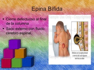 Epina Bífida
 Cierre defectuoso al final
de la columna
 Saco externo con fluído
cerebro espinal.

 