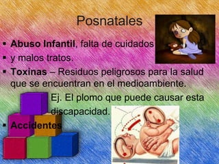 Posnatales
 Abuso Infantil, falta de cuidados
 y malos tratos.
 Toxinas – Residuos peligrosos para la salud
que se encuentran en el medioambiente.
Ej. El plomo que puede causar esta
discapacidad.
 Accidentes

 