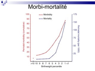 Morbi-mortalité
 