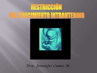 RESTRICCIÓN  DEL CRECIMIENTO INTRAUTERINO Dra. Jenniefer Cumes M. 