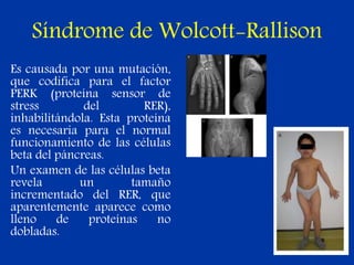 Síndrome de Wolcott-Rallison
Es causada por una mutación,
que codifica para el factor
PERK (proteína sensor de
stress del RER),
inhabilitándola. Esta proteína
es necesaria para el normal
funcionamiento de las células
beta del páncreas.
Un examen de las células beta
revela un tamaño
incrementado del RER, que
aparentemente aparece como
lleno de proteínas no
dobladas.
 