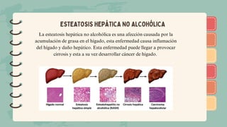 )
)
)
)
)
)
)
)
)
)
)
)
)
)
)
)
)
)
ESTEATOSIS HEPÁTICA NO ALCOHÓLICA
La esteatosis hepática no alcohólica es una afección causada por la
acumulación de grasa en el hígado, esta enfermedad causa inflamación
del hígado y daño hepático. Esta enfermedad puede llegar a provocar
cirrosis y esta a su vez desarrollar cáncer de hígado.
 