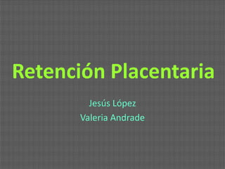 Retención Placentaria
Jesús López
Valeria Andrade

 