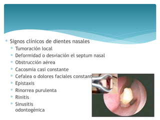 ∗ Signos clínicos de dientes nasales
∗ Tumoración local
∗ Deformidad o desviación el septum nasal
∗ Obstrucción aérea
∗ Cacosmia casi constante
∗ Cefalea o dolores faciales constantes
∗ Epistaxis
∗ Rinorrea purulenta
∗ Rinitis
∗ Sinusitis  
odontogénica
 