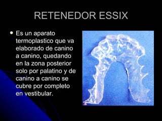RETENEDOR ESSIX Es un aparato termoplastico que va elaborado de canino a canino, quedando en la zona posterior solo por palatino y de canino a canino se cubre por completo en vestibular. 