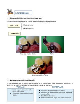 B. RETENEDORES
1.- ¿Cómo se clasifican los retenedores y por qué?
Se clasifican en dos grupos, en función del tipo de apoyo que proporcionan.
Intracoronarios
Extracoronarios
Retenedor directo: Matrix Pátrix
Unión de matrix y Patrix
2.- ¿Qué es un retenedor intracoronario?
Es un retenedor que se coloca en el interior de la corona para crear resistencia friccional a la
remoción. Se conoce como atache o aditamento interno de precisión.
VENTAJAS DESVENTAJAS
DIRECTOS
INDIRECTOS
• Existe mayor estimulación de los
tejidos subyacentes
• Eliminan el componente retentivo
visible.
• Requieren pilares preparados y colados.
• Requieren un procedimiento clínico y de laboratorio
más complejo.
• Son difíciles de reparar.
• Se requieren dientes largos para lograr su eficacia.
 