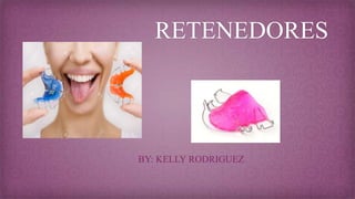 RETENEDORES
BY: KELLY RODRIGUEZ
 