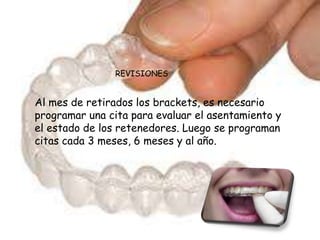 REVISIONES


Al mes de retirados los brackets, es necesario
programar una cita para evaluar el asentamiento y
el estado de los retenedores. Luego se programan
citas cada 3 meses, 6 meses y al año.
 