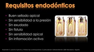 Mayor posibilidad de fracturaConsideraciones de los dientes tratados con endodonciaUn tratamiento de endodoncia genera un cambio en la arquitectura de la estructura dentaria  que va a afectar el Comportamiento biomecánico del diente 