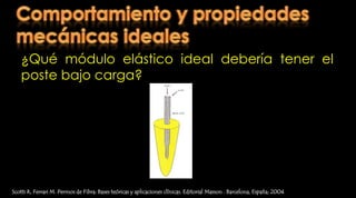 Postes prefabricados  Scotti R, Ferrari M. Permos de Fibra: Bases teóricas y aplicaciones clínicas. Editorial Masson . Barcelona, España; 2004