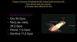Macro y microestructura de los postesFormas de los postesScotti R, Ferrari M. Permos de Fibra: Bases teóricas y aplicaciones clínicas. Editorial Masson . Barcelona, España; 2004