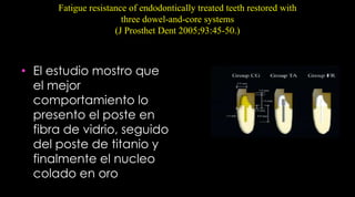 Macro y microestructura de los postesScotti R, Ferrari M. Permos de Fibra: Bases teóricas y aplicaciones clínicas. Editorial Masson . Barcelona, España; 2004