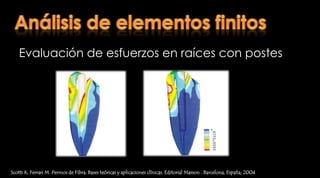 Comportamiento y propiedades mecánicas idealesScotti R, Ferrari M. Permos de Fibra: Bases teóricas y aplicaciones clínicas. Editorial Masson . Barcelona, España; 2004