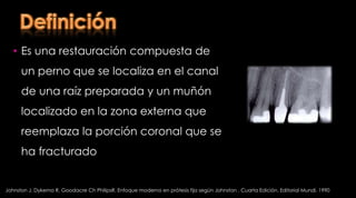 Los dientes tratados con endodoncia mostraron una disminución de la resistencia cuspídea del 5% , los que fueron sometidos a restauraciones oclusales 20% y MOD 63%