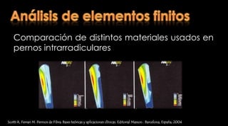 Comportamiento y propiedades mecánicas idealesFactores que influyen en el pronóstico del posteScotti R, Ferrari M. Permos de Fibra: Bases teóricas y aplicaciones clínicas. Editorial Masson . Barcelona, España; 2004