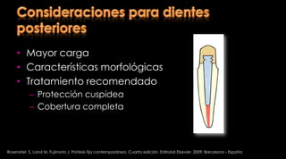 Definición Se realiza en materiales rígidos que al ser cementados en el conducto radicular y la cámara pulpar, brinda una base sólida retenida en el dienteJohnston J, Dykema R, Goodacre Ch PhilipsR. Enfoque moderno en prótesis fija según Johnston . Cuarta Edición. Editorial Mundi. 1990