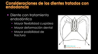 No produce más dentina