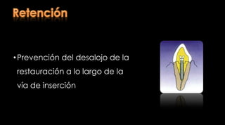 Clasificación Según su fabricaciónColadosMetal baseMetales noblesPrefabricados Metálicos Fibra de carbono Cerámicos Fibra de vidrio Rosenstiel  S, Land M, Fujimoto J. Prótesis fija contemporánea. Cuarta edición. Editorial Elsevier. 2009; Barcelona - España