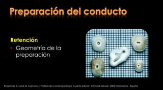 Resistencia a la fractura de raíces debilitadas restauradas con un poste transparente y materiales restaurativos adesivosLas raíces debilitadas que se reforzaron con postes y que se reforzaron con resinas (Luminex) y TetricCeram, FiltekSupreme,  Z100, aumentaron la resistencia a la fractura comparado con raíces sobreinstrumentadas a las que le colocaron postes de CuAl