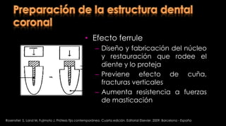 Preparación del conductoRetención Geometría de la preparaciónRosenstiel  S, Land M, Fujimoto J. Prótesis fija contemporánea. Cuarta edición. Editorial Elsevier. 2009; Barcelona - España