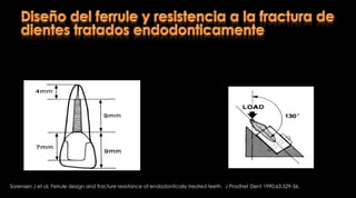 Preparación del conductoRetención Resistencia a la rotaciónUn poste con sección transversal circular no debe rotarSuficiente estructura dental coronal resistencia la da el muñón.Rosenstiel  S, Land M, Fujimoto J. Prótesis fija contemporánea. Cuarta edición. Editorial Elsevier. 2009; Barcelona - España