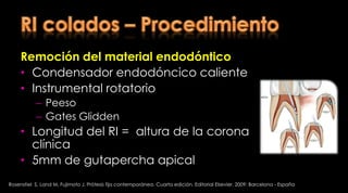 Resistencia a la fractura in vitro de incisivos centrales tratados endodónticamente con alturas y configuraciones variables de ferruleTan P et al. In vitro fracture resistance of endodonticallytreated central incisorswithvaryingferruleheights and configurations . Journal of Prosthetic Dentistry  2005; Volume 93, Issue 4: 331-336 