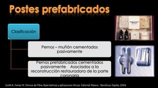 Efecto del ferrule en la resistencia a la fractura de dientes tratados endodonticamenterestaurados con postes prefabricadosEvaluaron postes prefabicados y nucleos colados con diferentes alturas de ferrule 0, 1, 2 y 3 mmSe aplicaroncargas entre 133 y 330 GpsRicardo J et al. Effectof a crownferruleonthe fracture resistance of endodonticallytreatedteethrestoredwithprefabricatedposts. J ProsthetDent 2006;95:50-4.