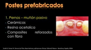 Efecto del ferrule en la resistencia a la fractura de dientes tratados endodonticamenterestaurados con postes prefabricadosEl incremento de la altura del ferrule aumenta la resistencia a la fracturaPresenta mejor comportamiento los poste en fibra de vidrio que los coladosRicardo J et al. Effect of a crown ferrule on the fracture resistance of endodontically treated teeth restored with prefabricated posts. J Prosthet Dent 2006;95:50-4.