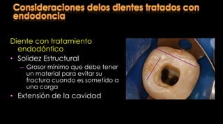 Mayor flexibilidad cuspídea