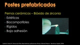 RI colados – ProcedimientoTécnica directa para dientes unirradiculares