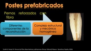 RI colados – Procedimiento