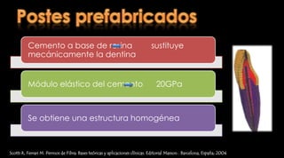 Postes prefabricados  2. Pernos preformados pasivos Scotti R, Ferrari M. Permos de Fibra: Bases teóricas y aplicaciones clínicas. Editorial Masson . Barcelona, España; 2004