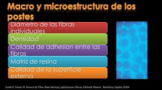 Postes prefabricados  Pernos metálicosSegún su forma:Lisos 