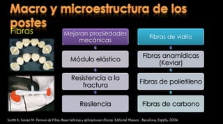 Roscas retentivasNunca existe un contacto íntimo entre el perno y la superficie radicularScotti R, Ferrari M. Permos de Fibra: Bases teóricas y aplicaciones clínicas. Editorial Masson . Barcelona, España; 2004