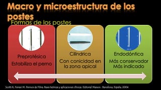 Postes prefabricados  Scotti R, Ferrari M. Permos de Fibra: Bases teóricas y aplicaciones clínicas. Editorial Masson . Barcelona, España; 2004
