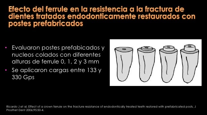 Retenedores intrarradiculares definitivo