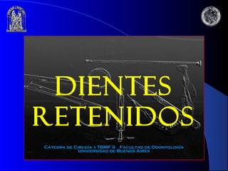 DIENTES
RETENIDOS
Cátedra de Cirugía y TBMF II Facultad de Odontología
Universidad de Buenos Aires
 