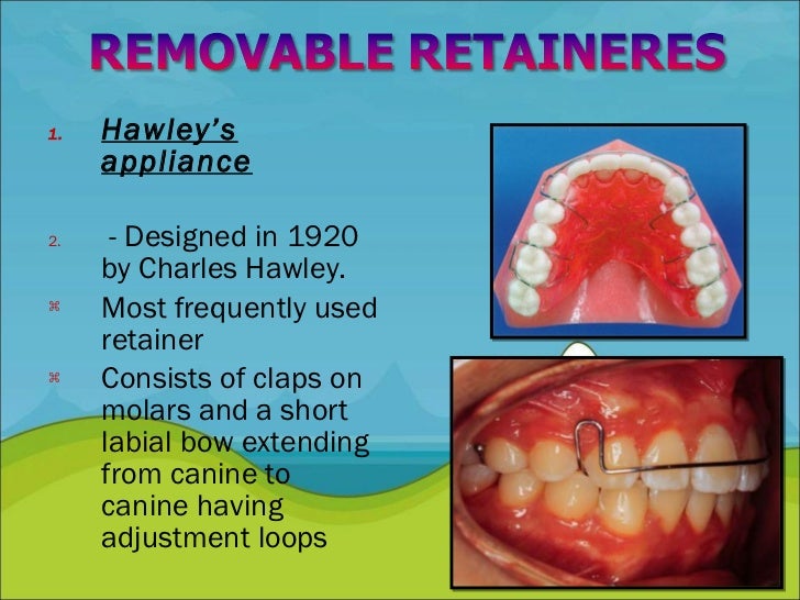 Retention and Relapse in orthodontics