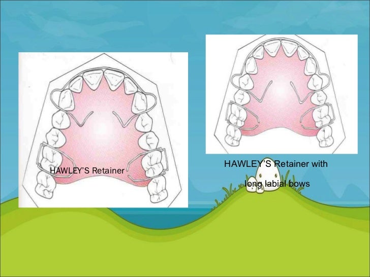 Retention and Relapse in orthodontics