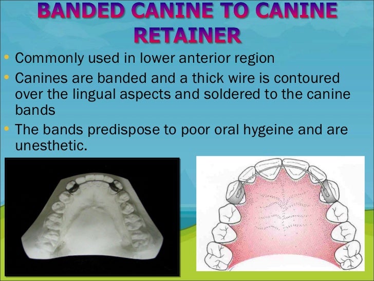 Retention and Relapse in orthodontics