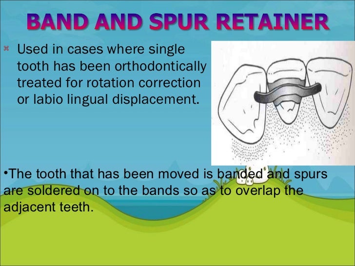 Retention and Relapse in orthodontics