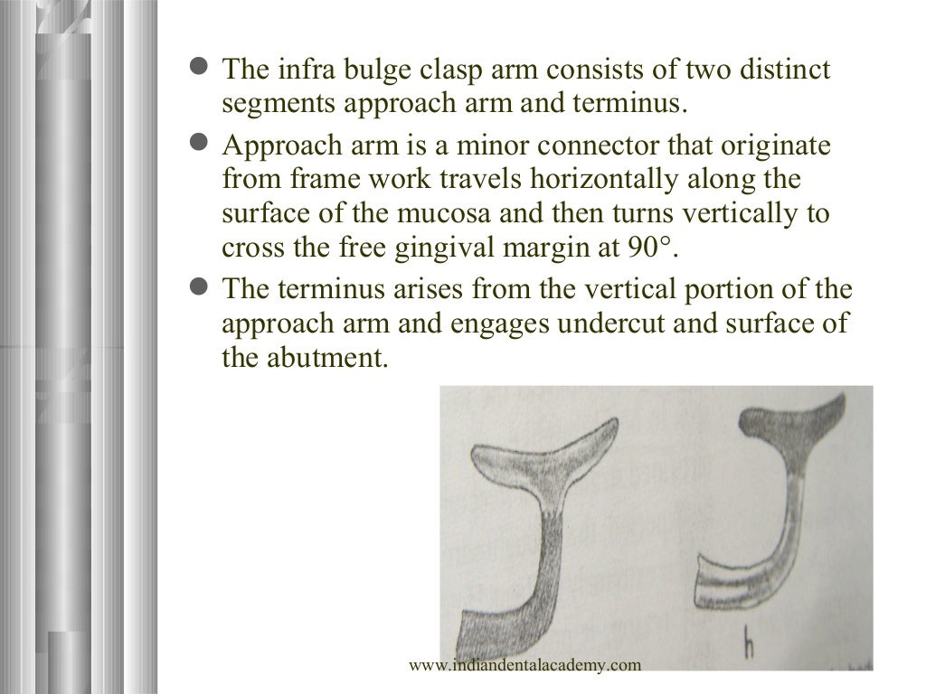 Clasp Retention in RPD / Labial orthodontics course