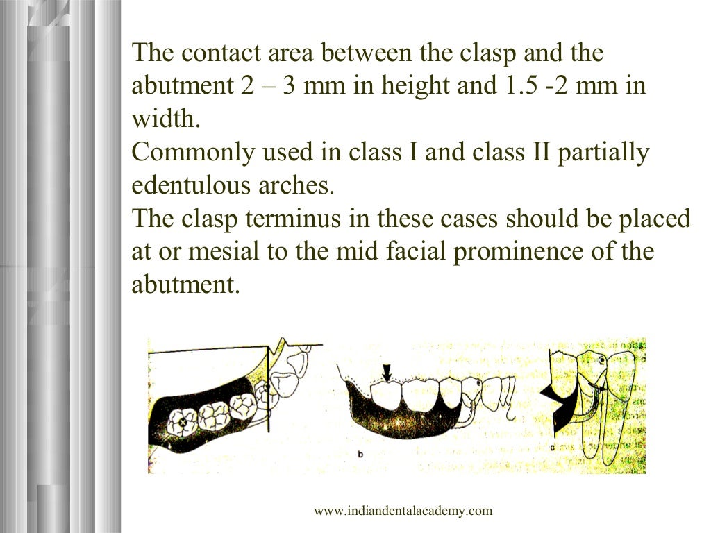 Clasp Retention in RPD / Labial orthodontics course