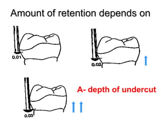 Amount of retention depends onAmount of retention depends on
The greater the distance we go into the undercut the greater will be the retention
A- depth of undercut
 