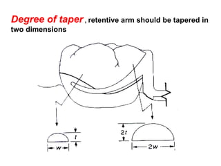 Degree of taper , retentive arm should be tapered in
two dimensions
 