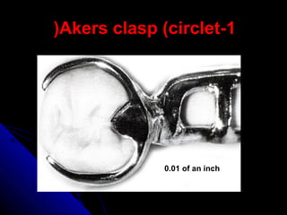 1-Akers clasp (circlet(
0.01 of an inch
 